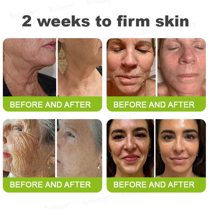 🇨🇦 Proudly Formulated & Shipped from Canada🍁Rolimey® Botox & Vita-A Retinol Shot Wrinkle-Lift Tightening Cream Last Day Promotion: 50% OFF