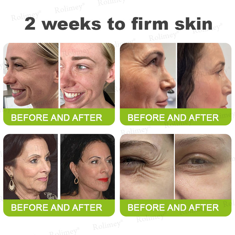 🇨🇦 Proudly Formulated & Shipped from Canada🍁Rolimey® Botox & Vita-A Retinol Shot Wrinkle-Lift Tightening Cream Last Day Promotion: 50% OFF