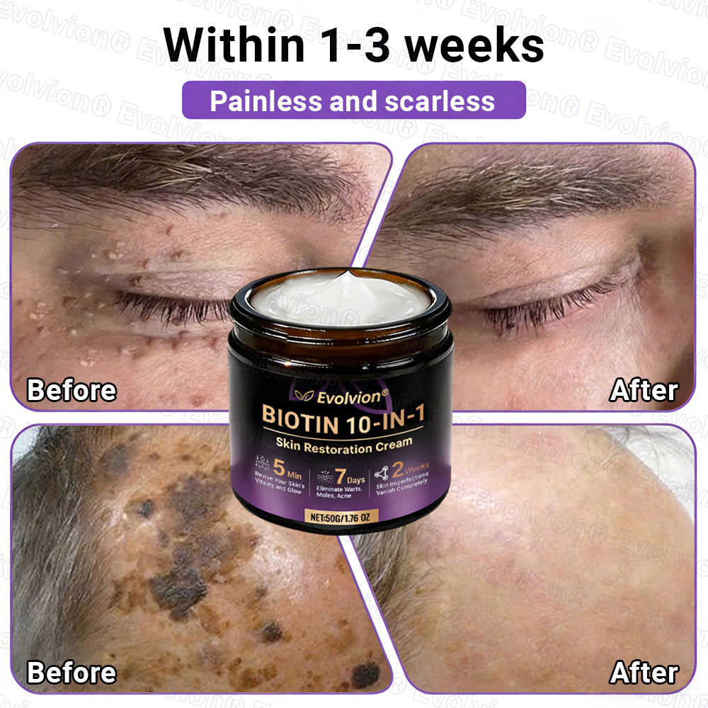 Made and Shipped from Canada🍁🔖Evolvion® Biotin 10-in-1 Skin Restoration Cream - Last Day Promotion: 50% OFF
