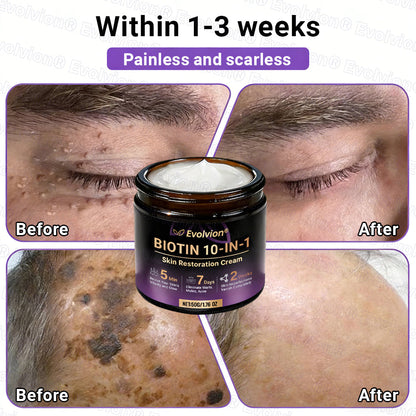 Made and Shipped from Canada🍁🔖Evolvion® Biotin 10-in-1 Skin Restoration Cream - Last Day Promotion: 50% OFF