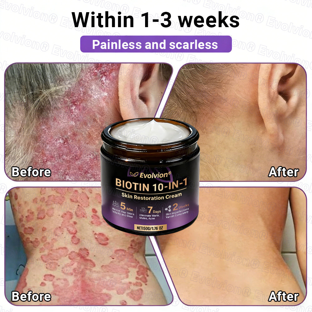 Made and Shipped from Canada🍁🔖Evolvion® Biotin 10-in-1 Skin Restoration Cream - Last Day Promotion: 50% OFF