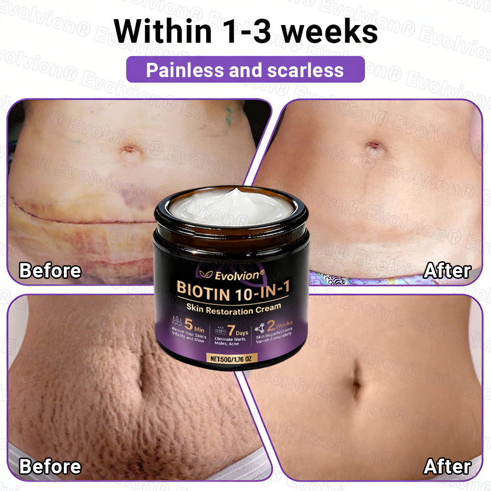 Made and Shipped from Canada🍁🔖Evolvion® Biotin 10-in-1 Skin Restoration Cream - Last Day Promotion: 50% OFF