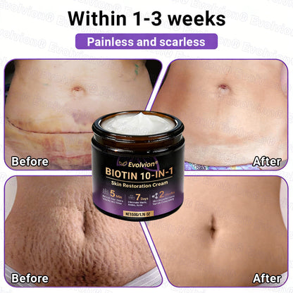 Made and Shipped from Canada🍁🔖Evolvion® Biotin 10-in-1 Skin Restoration Cream - Last Day Promotion: 50% OFF