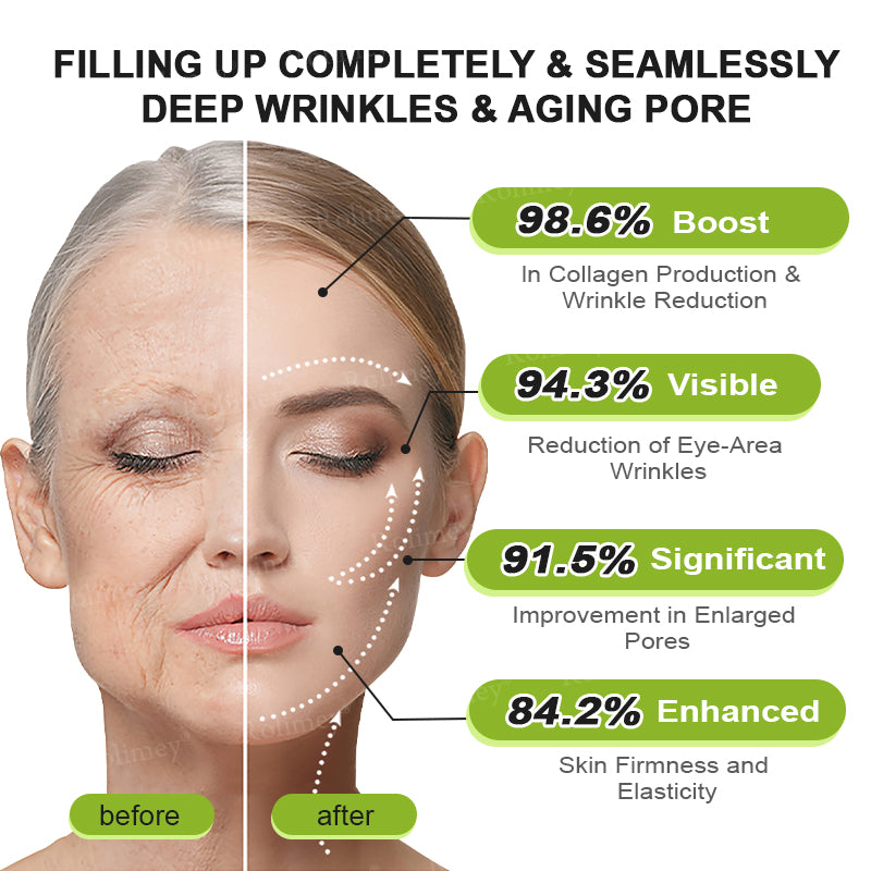 🇨🇦 Proudly Formulated & Shipped from Canada🍁Rolimey® Botox & Vita-A Retinol Shot Wrinkle-Lift Tightening Cream Last Day Promotion: 50% OFF