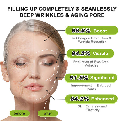 🇨🇦 Proudly Formulated & Shipped from Canada🍁Rolimey® Botox & Vita-A Retinol Shot Wrinkle-Lift Tightening Cream Last Day Promotion: 50% OFF