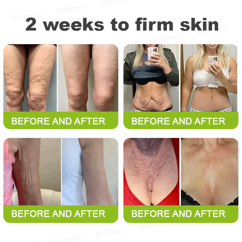 🇨🇦 Proudly Formulated & Shipped from Canada🍁Rolimey® Botox & Vita-A Retinol Shot Wrinkle-Lift Tightening Cream Last Day Promotion: 50% OFF