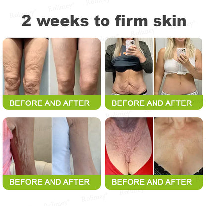 🇨🇦 Proudly Formulated & Shipped from Canada🍁Rolimey® Botox & Vita-A Retinol Shot Wrinkle-Lift Tightening Cream Last Day Promotion: 50% OFF