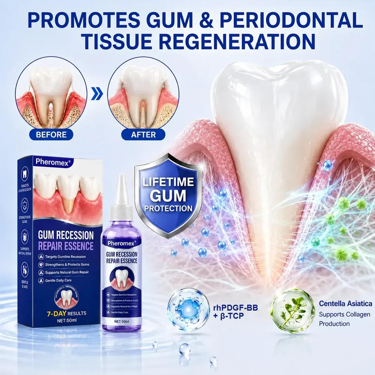 Pheromex® 🦷GumRevive Periodontal Care Gel🛑