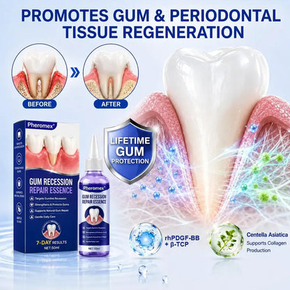 Pheromex® 🦷GumRevive Periodontal Care Gel🛑