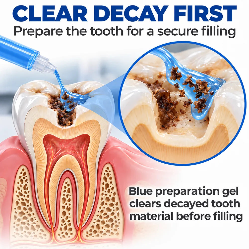 Dr.Fachmer® DentRestore Tooth Repair & Filling System 🪷