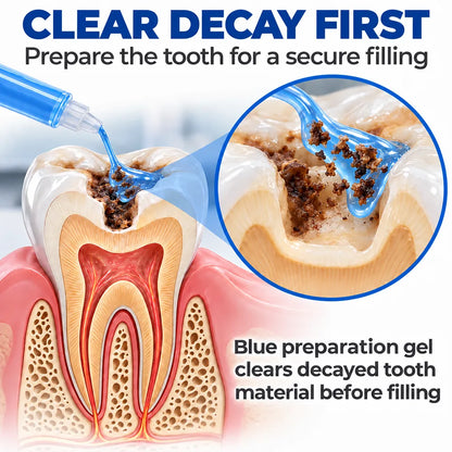 Dr.Fachmer® DentRestore Tooth Repair & Filling System 🪷
