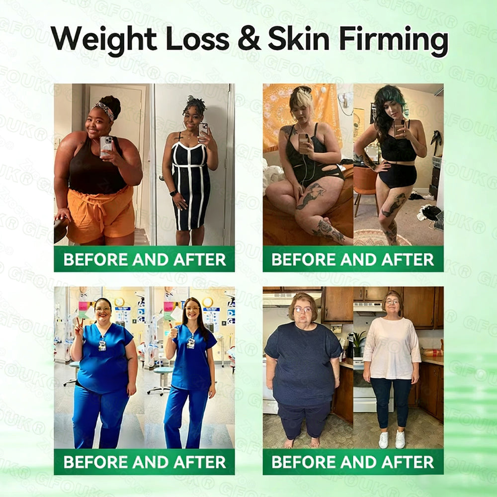 𝐎𝐟𝐟𝐢𝐜𝐢𝐚𝐥 𝐒𝐭𝐨𝐫𝐞 🇨🇦 | 𝐆𝐅𝐎𝐔𝐊® 𝑴𝒐𝒓𝒊𝒏𝒈𝗮 · 𝗕𝗲𝗿𝗯𝗲𝗿𝙞𝙣𝙚 × 𝙉𝘼𝐃+ 𝟏𝟎-𝐢𝐧-𝟏 𝗔𝗱𝘃𝗮𝗻𝗰𝙚𝙙 𝙉𝙖𝙣𝙤 𝙈𝙞𝙘𝙧𝙤𝙣𝙚𝙚𝐝𝐥𝐞 𝐏𝐚𝐭𝙘𝙝 🇨🇦(𝐉𝐮𝐬𝐭 𝐨𝐧𝐜𝐞 𝐚 𝐝𝐚𝐲, 𝐯𝐢𝐬𝐢𝐛𝐥𝐞 𝐜𝐡𝐚𝐧𝐠𝐞𝐬 𝐢𝐧 𝟕 𝐝𝐚𝐲𝐬）✅ 𝐅𝐨𝐫 𝐨𝐛𝐞𝐬𝐢𝐭𝐲, 𝐥𝐨𝐨𝐬𝐞 𝐬𝐤𝐢𝐧,𝐝𝐢𝐚𝐛𝐞𝐭𝐞𝐬, 𝐬𝐥𝐞𝐞𝐩 𝐚𝐩𝐧𝐞𝐚, 𝐣𝐨𝐢𝐧𝐭 𝐢𝐬𝐬𝐮𝐞𝐬, 𝐚𝐧𝐝 𝐦𝐨𝐫𝐞