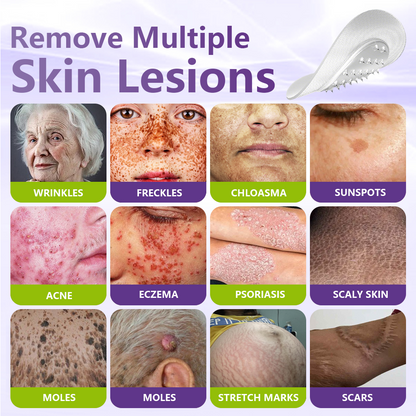 𝐎𝐟𝐟𝐢𝐜𝐢𝐚𝐥 𝐒𝐭𝐨𝐫𝐞 🇨🇦 |🍁💖💕GFOUK® Soluble Microneedle Botanical Skin Tag Removal Patch