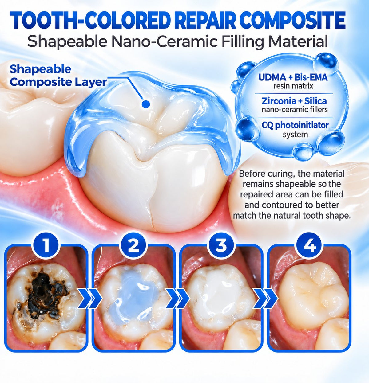 Dr.Fachmer® DentRestore Tooth Repair & Filling System 🪷