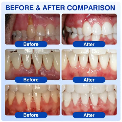 Pheromex® 🦷GumRevive Periodontal Care Gel🌺