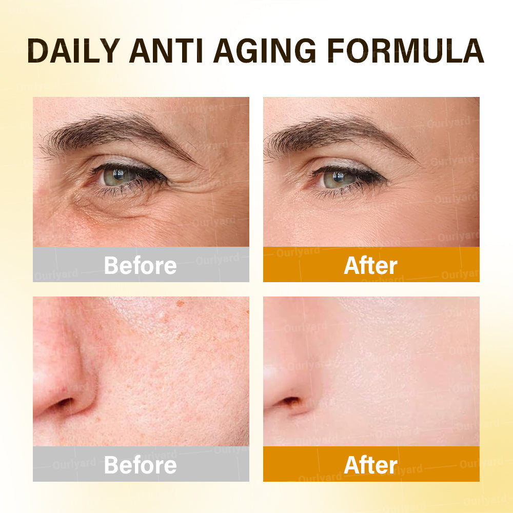 ✅Official Store |🍁🎁Rolimey® Anti-Aging Moisturizing Cream with Hyaluronic Acid, Retinol & Collagen – For Face, Neck, Décolleté & Legs – Made in Canada – Day & Night Use