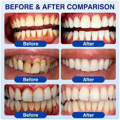 Pheromex® 🦷GumRevive Periodontal Care Gel🌺