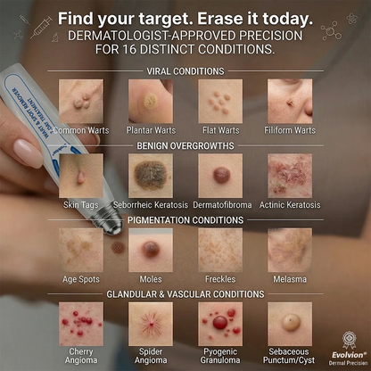 ✨🍁Evolvion® 𝟕-𝐃𝒂𝘆 𝐒𝗸𝐢𝐧 𝐓𝒂𝗴 & 𝐒𝐩𝙤𝐭 𝐄𝐫𝒂𝐬𝙚𝐫 Painless & Scar-Free Advanced Imperfection Remova𝗜 Ro𝗜𝗜erba𝗜𝗜 Pen