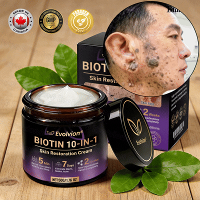 Made and Shipped from Canada🍁👨‍⚕️Evolvion® Biotin 10-in-1 Skin Restoration Cream - Last Day Promotion: 50% OFF