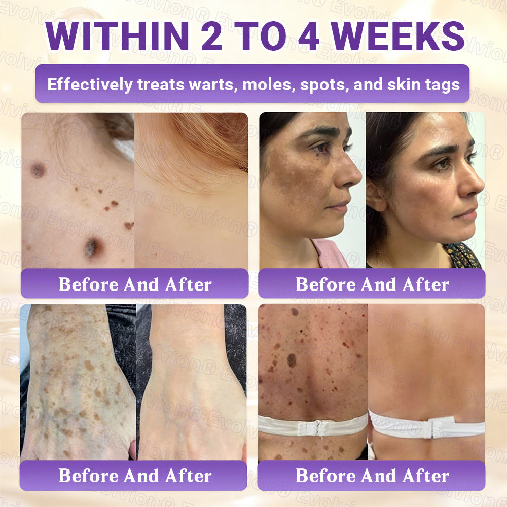 Made and Shipped from Canada🍁🔖Evolvion® Biotin 10-in-1 Skin Restoration Cream - Last Day Promotion: 50% OFF