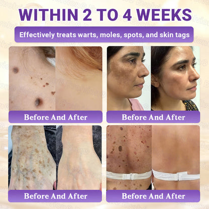 Made and Shipped from Canada🍁🔖Evolvion® Biotin 10-in-1 Skin Restoration Cream - Last Day Promotion: 50% OFF