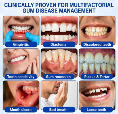 Pheromex® 🦷GumRevive Periodontal Care Gel🛑