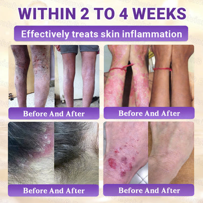 Made and Shipped from Canada🍁🔖Evolvion® Biotin 10-in-1 Skin Restoration Cream - Last Day Promotion: 50% OFF