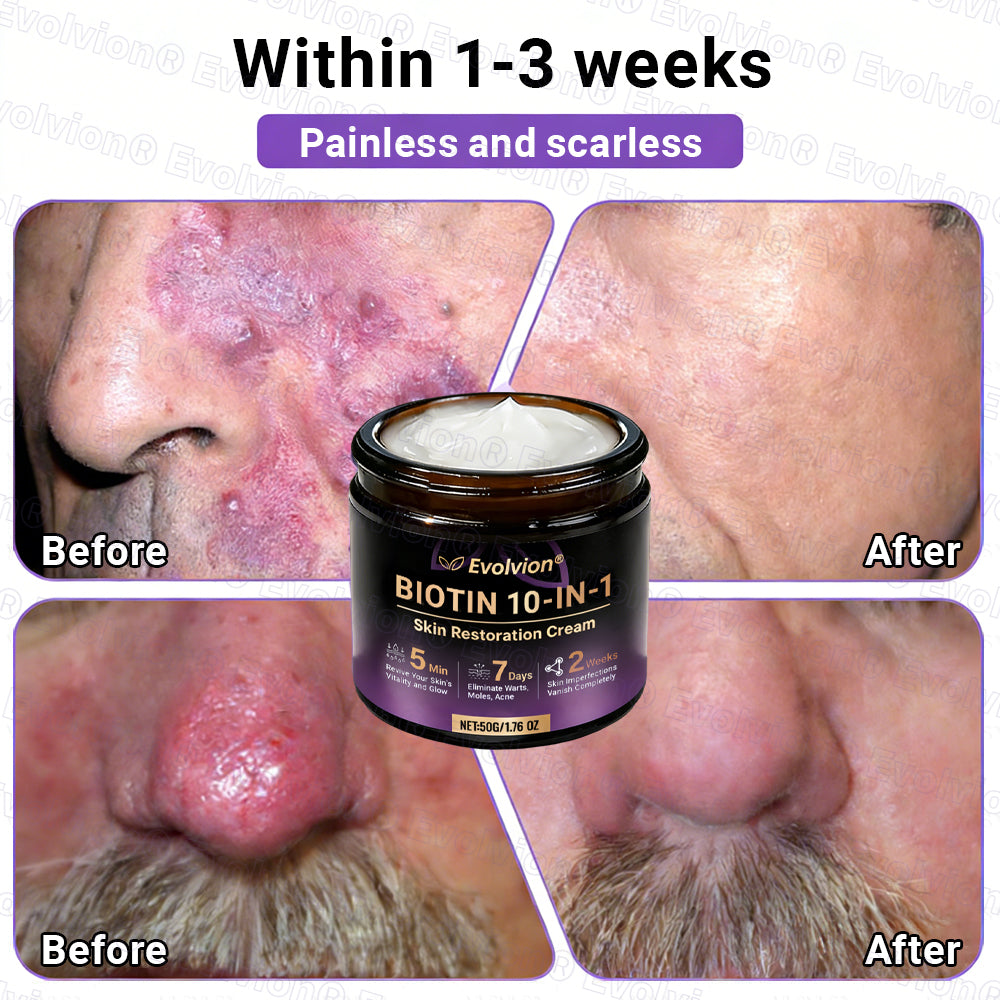 Made and Shipped from Canada🍁🔖Evolvion® Biotin 10-in-1 Skin Restoration Cream - Last Day Promotion: 50% OFF