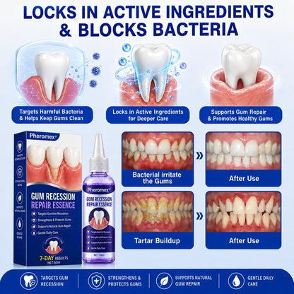 Pheromex® 🦷GumRevive Periodontal Care Gel🌺