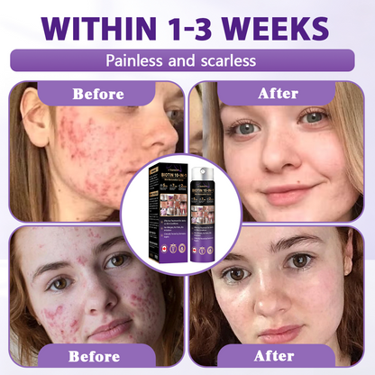 Made and Shipped from Canada✨Evolvion® Biotin 10-in-1 Skin Restoration Spray 🍇