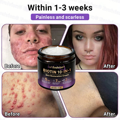 Made and Shipped from Canada🍁🔖Evolvion® Biotin 10-in-1 Skin Restoration Cream - Last Day Promotion: 50% OFF