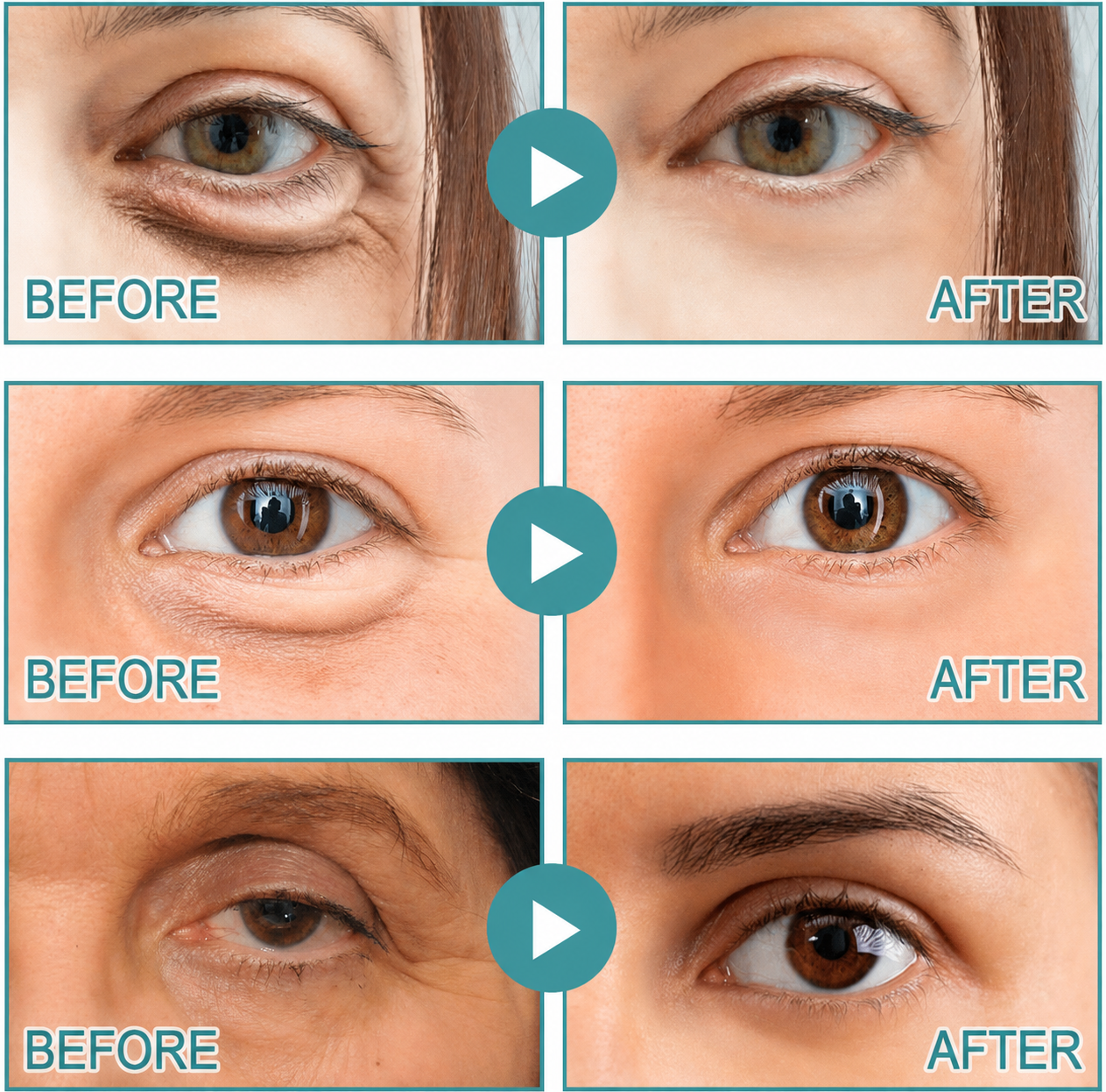 LAST DAY - BUY 1 GET 1 FREE🍁Toclvo® Dissolving Microneedle Eye Patches