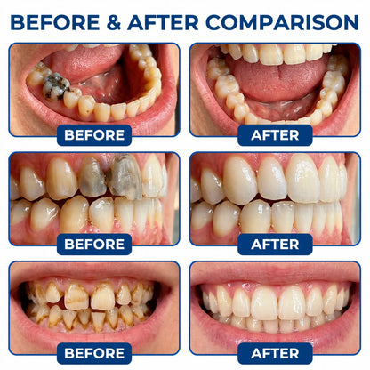 Dr.Fachmer® DentRestore Tooth Repair & Filling System 🪷
