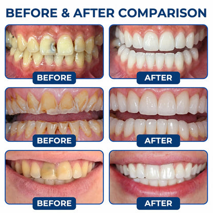 Dr.Fachmer® DentRestore Tooth Repair & Filling System 🪷
